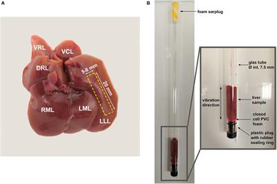 Changes in Liver Mechanical Properties and Water Diffusivity During Normal Pregnancy Are Driven by Cellular Hypertrophy